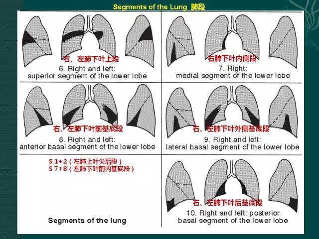 图解肺叶,肺段分布(初学者必备:基础知识) 