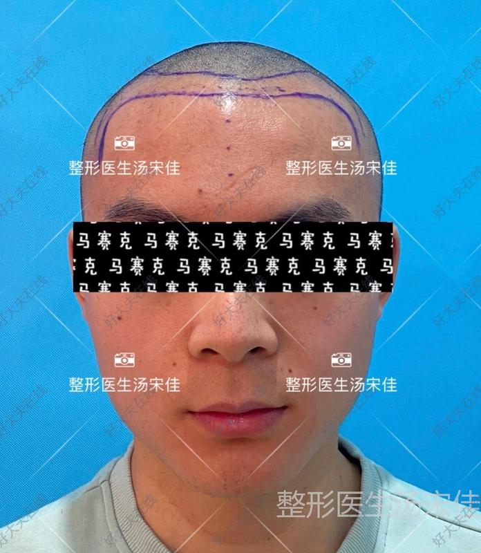圖文圖片