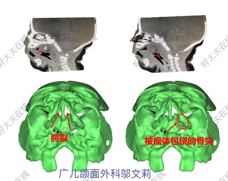 圖文圖片