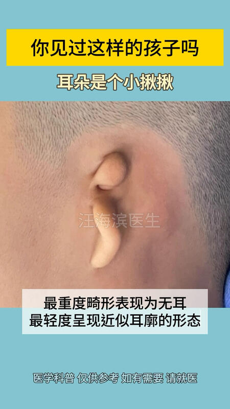 視頻封面