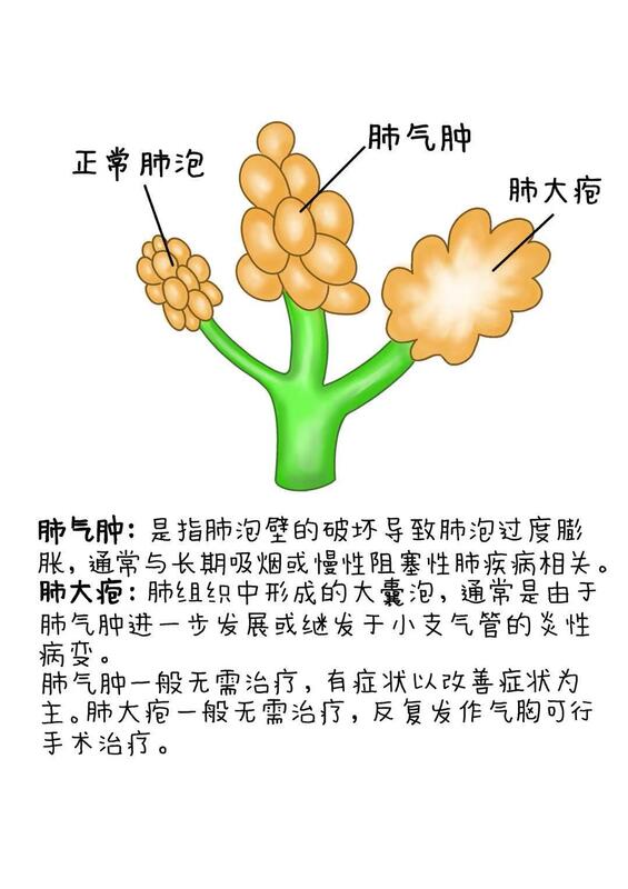 圖文圖片