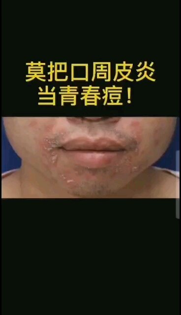 視頻封面