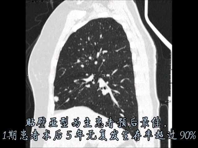 默认图片