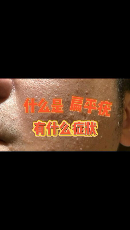 視頻封面