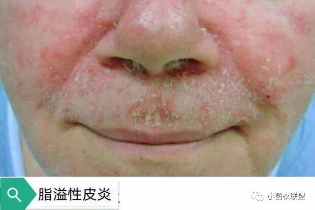 圖文圖片
