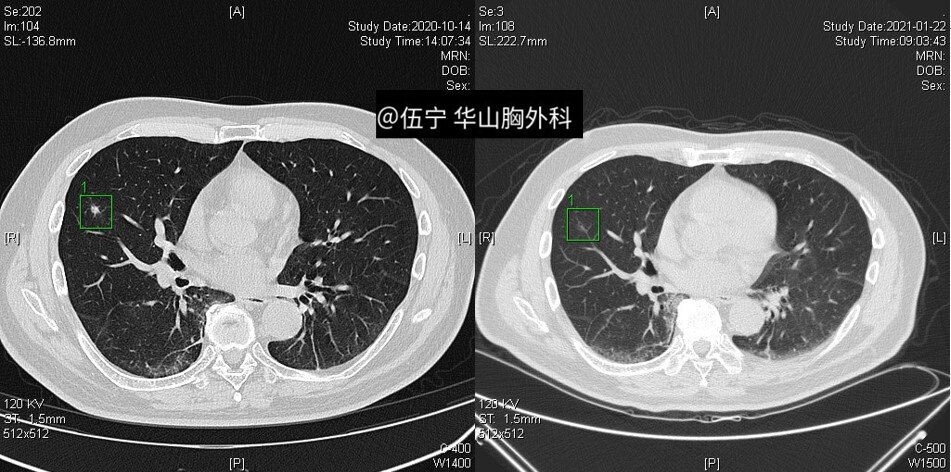 瑜松涛对比图.jpg