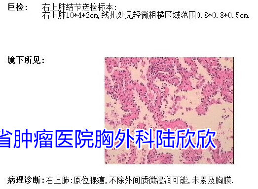 周永慧病理水印.jpg