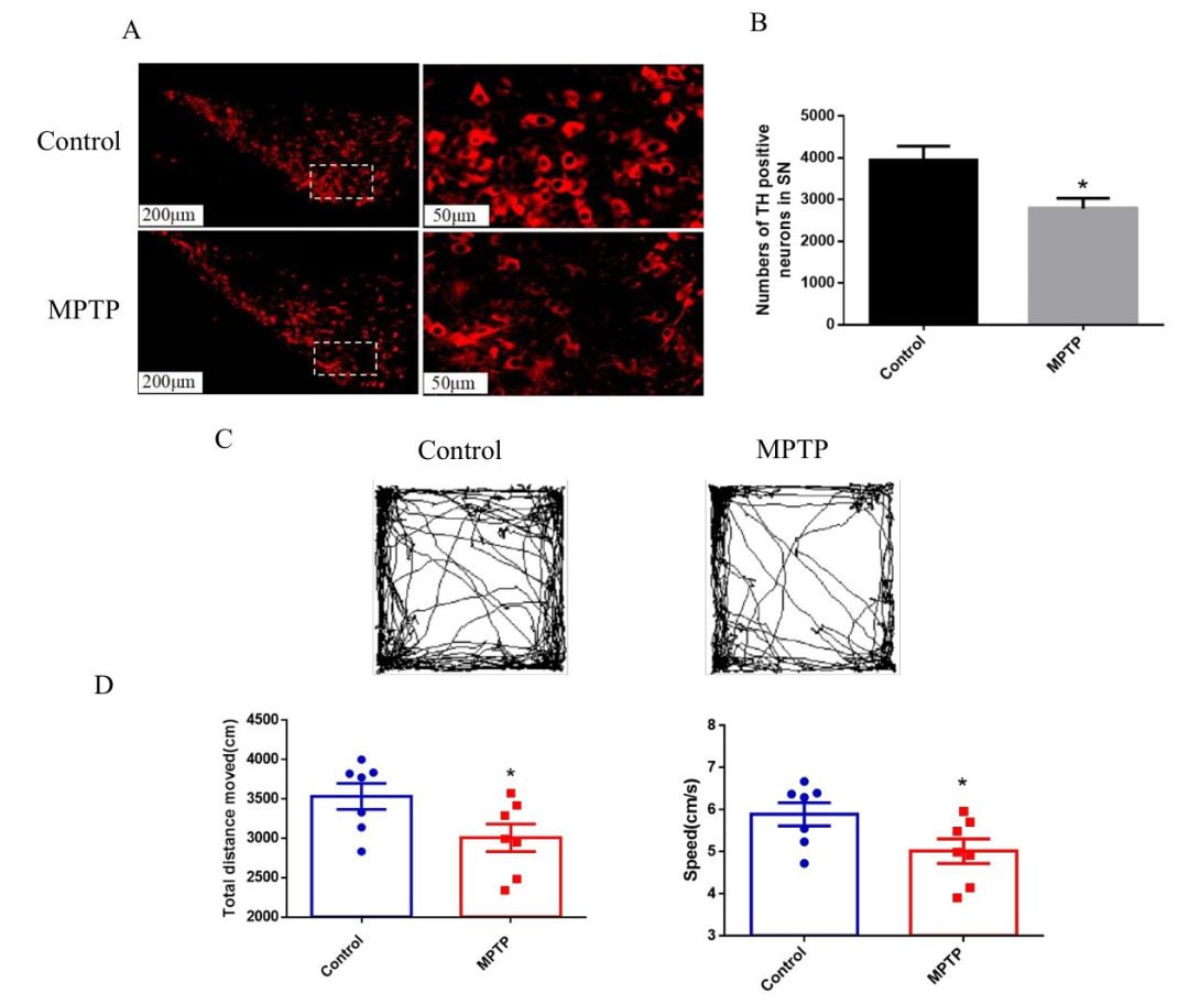 MPTP诱导PD小鼠模型如何建立与评估_帕金森_帕金森介绍 - 好大夫在线