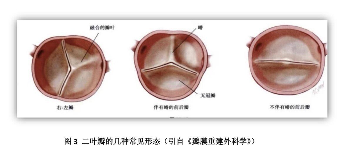 圖文圖片
