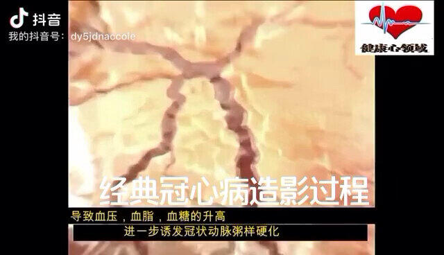 視頻封面
