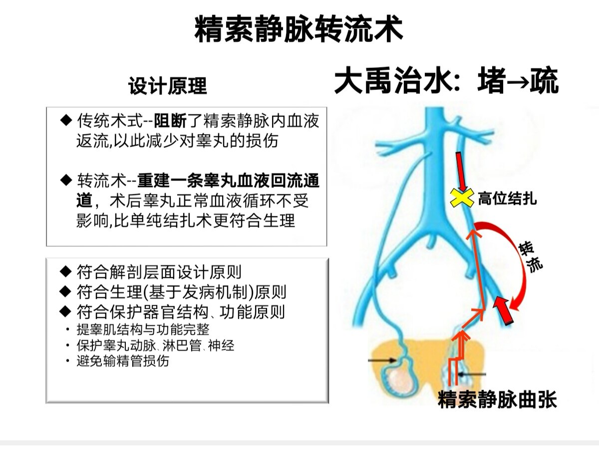 睾丸静脉解剖图图片