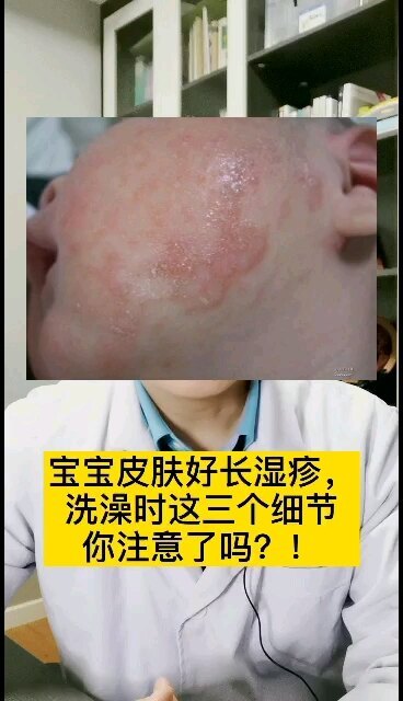 視頻封面