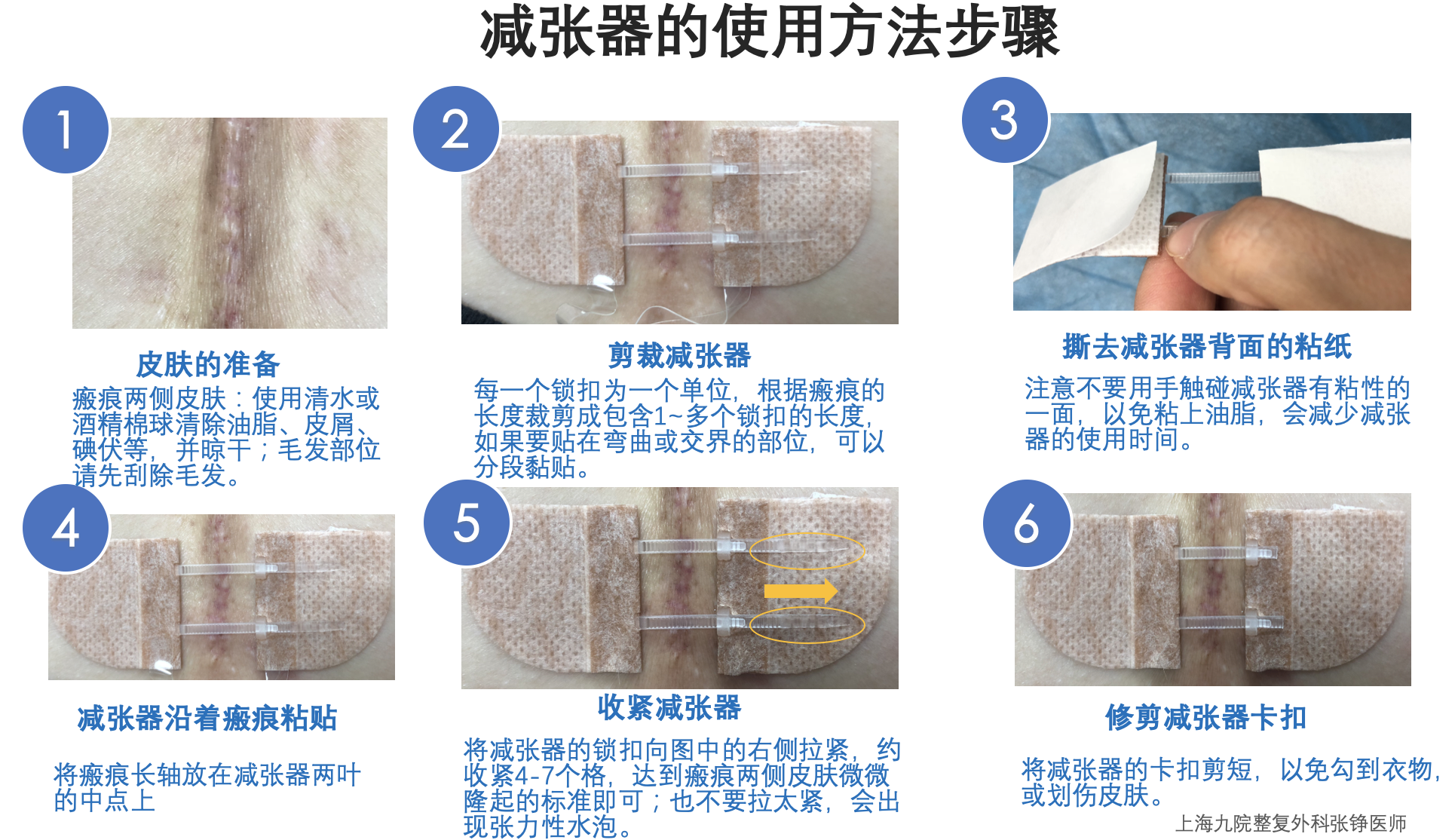 皮肤减张器的使用和疑问解答 - 好大夫在线