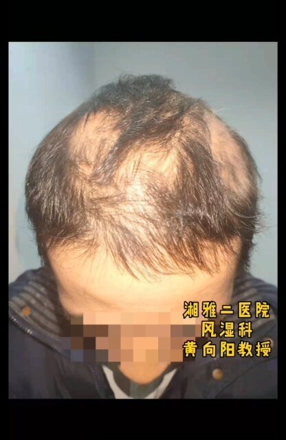 視頻封面