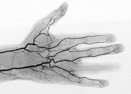 手指血管图图片