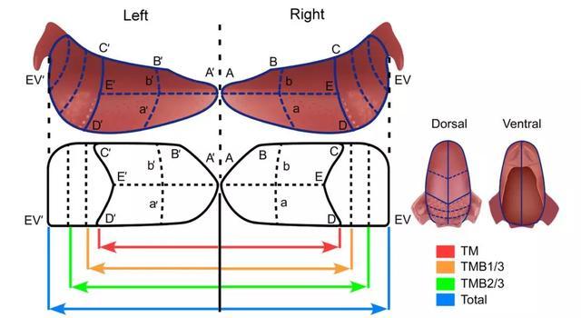 舌系带至舌下阜(b),口底粘膜和牙龈至后磨牙(c),界沟至舌盲孔(d)和