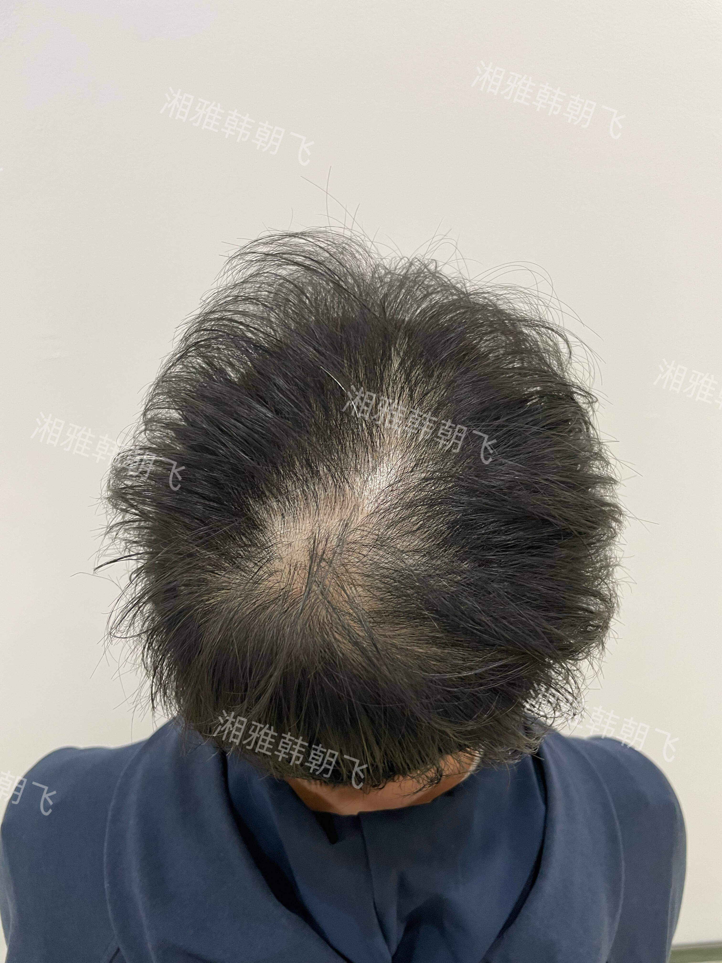 圖文圖片