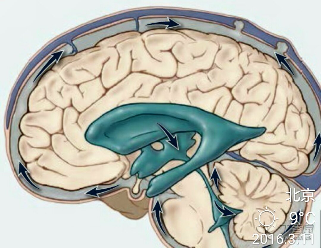 颅内压增高的临床表现 - 好大夫在线