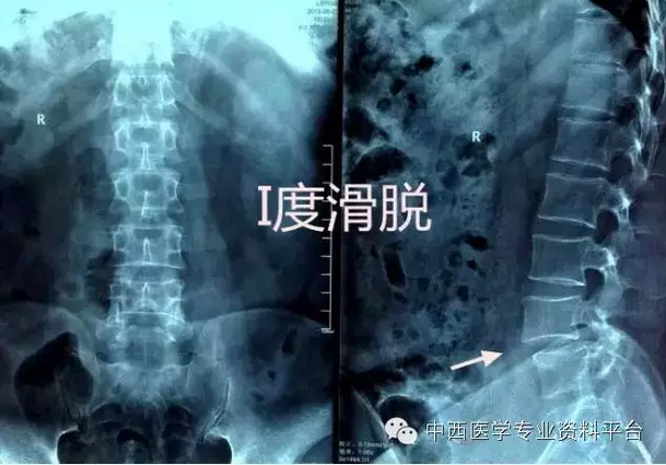 暂无