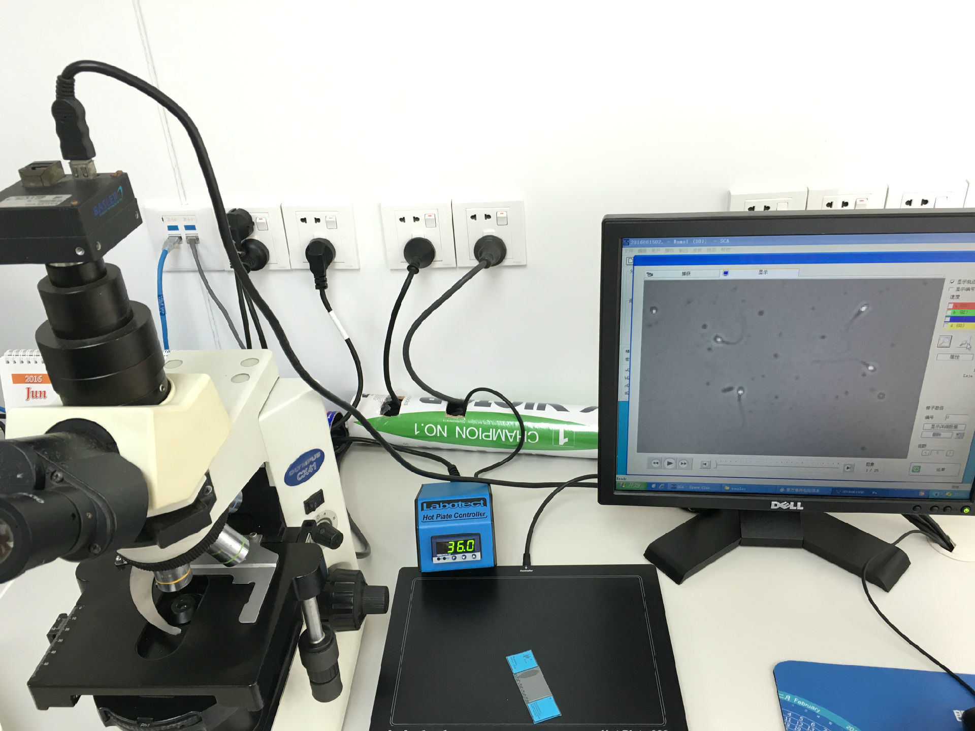 精子分析儀進行精子活動力及精子運動軌跡測定.