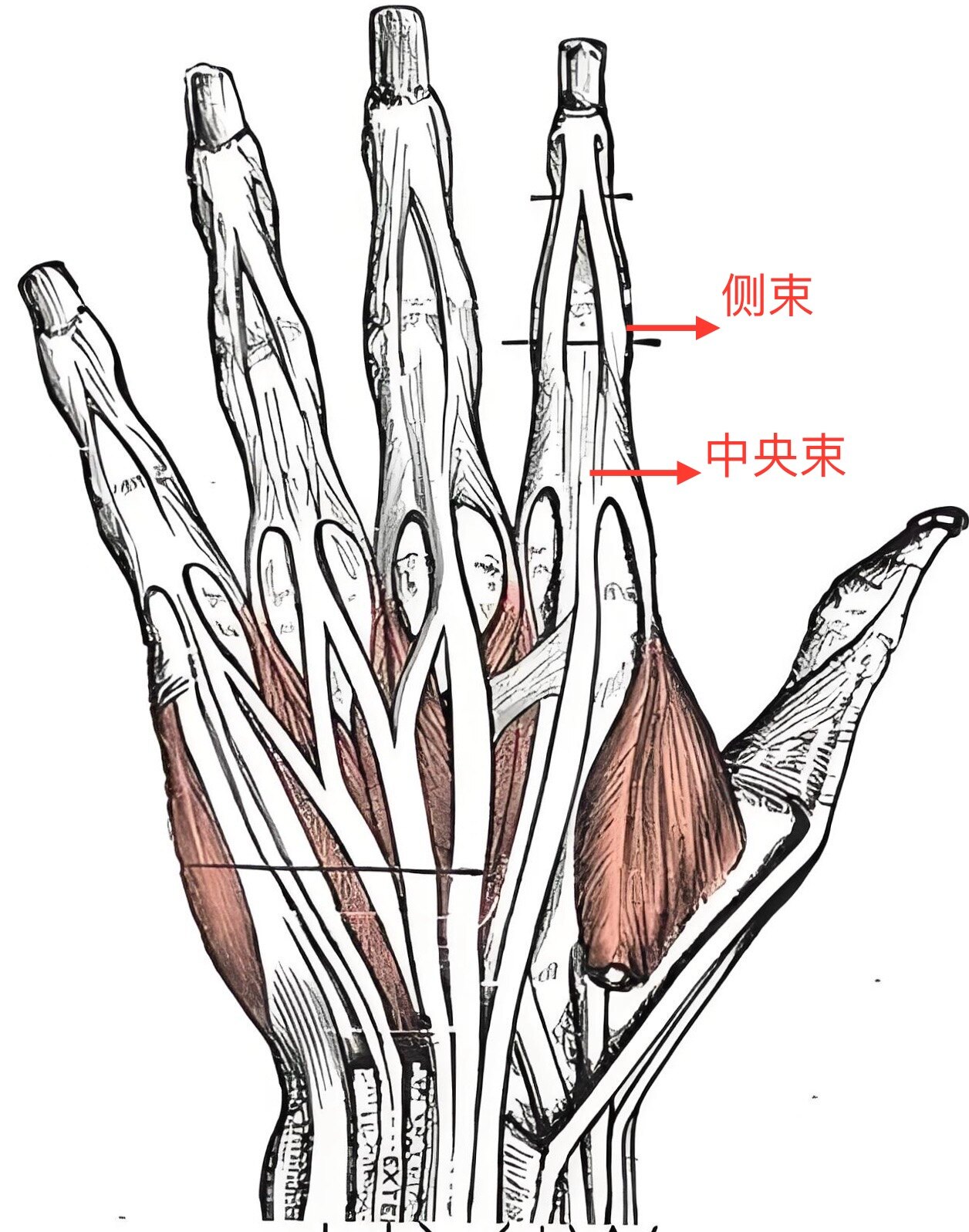 中央腱损伤之二 纽孔畸形(Boutonniere)畸形发生机制与对策探讨_手外伤_介绍_治疗方式 - 好大夫在线