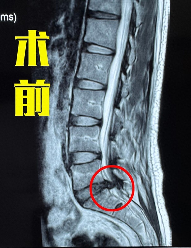 圖文圖片