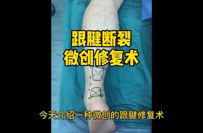 視頻封面