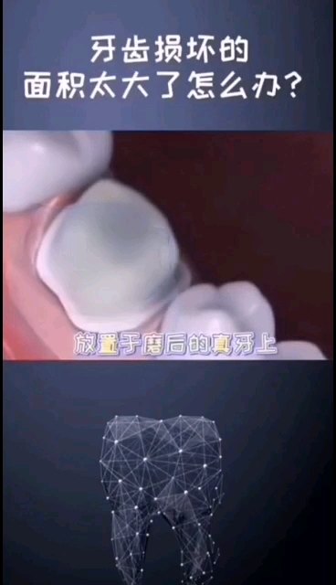 默认图片