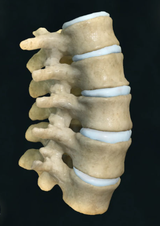 为什么有些脊柱手术需要打钉子(内固定)_脊柱侧弯_脊柱侧弯治疗方式