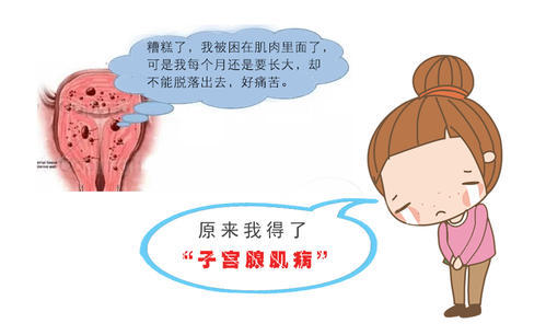 子宫肌腺症 子宫腺肌症_腺肌症要卧床保胎吗_肌腺症手术要多久