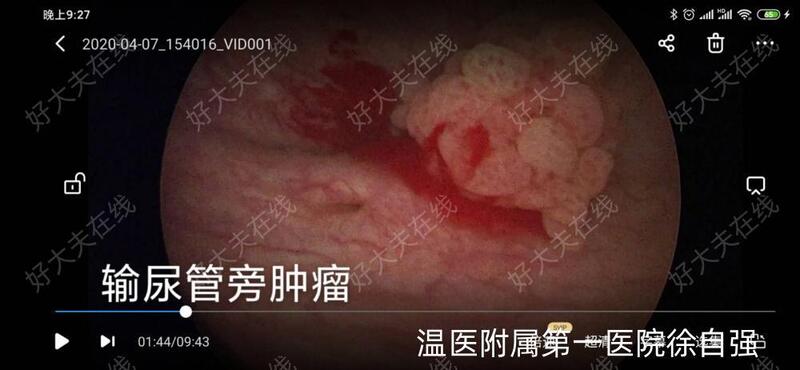 圖文圖片