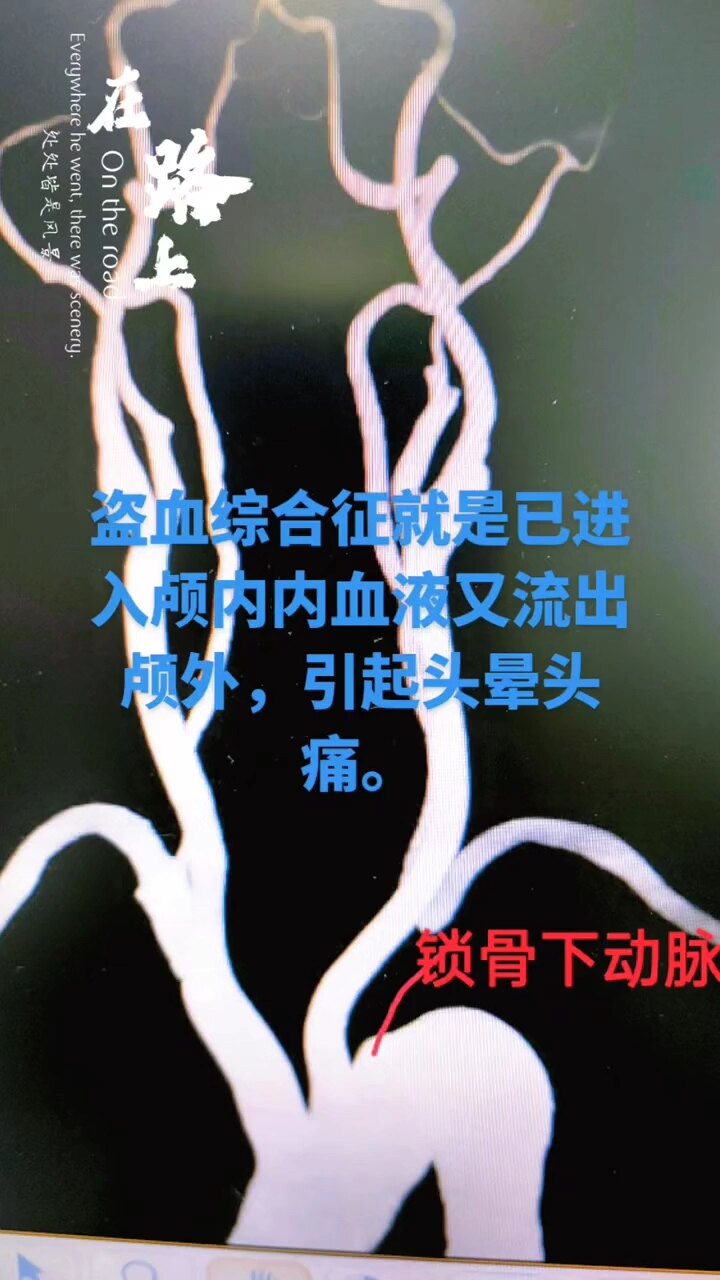 默认图片