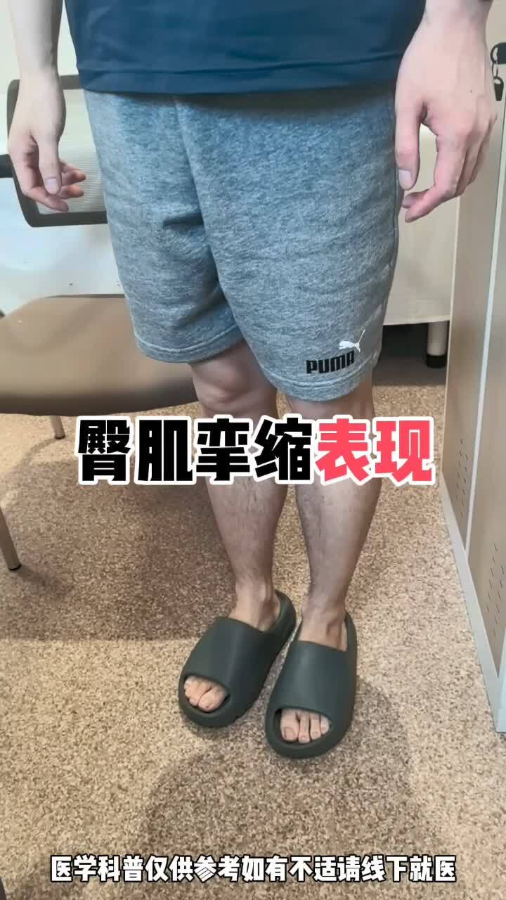 认识臀肌挛缩的常见特点