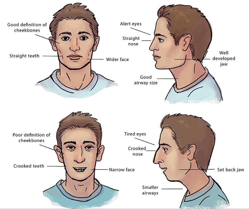 Mouth-Breathing-vs-Nasal-Breathing.jpg