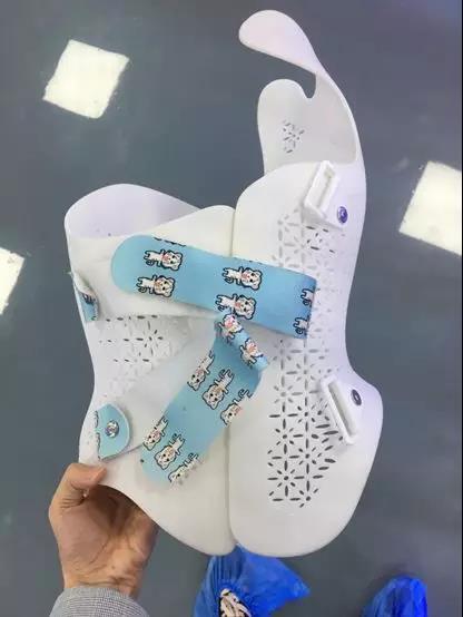 九院3d打印接诊中心——脊柱侧弯矫形器介绍_脊柱侧弯_治疗方式_日常