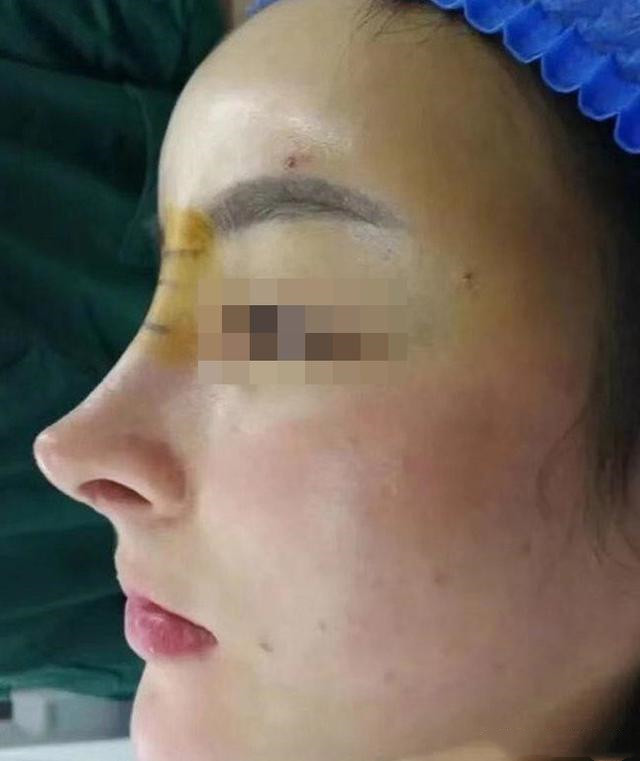 为什么老路要拒绝"网红高鼻子"?还劝大家不要做!