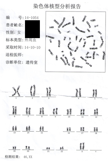 染色體檢查漏診病例(一) - 好大夫在線