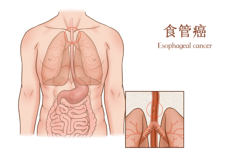 圖文圖片