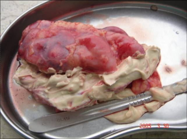 尿路感染症状?怎么引起的?用什么药?反复尿路感染的原因与防治_尿路感