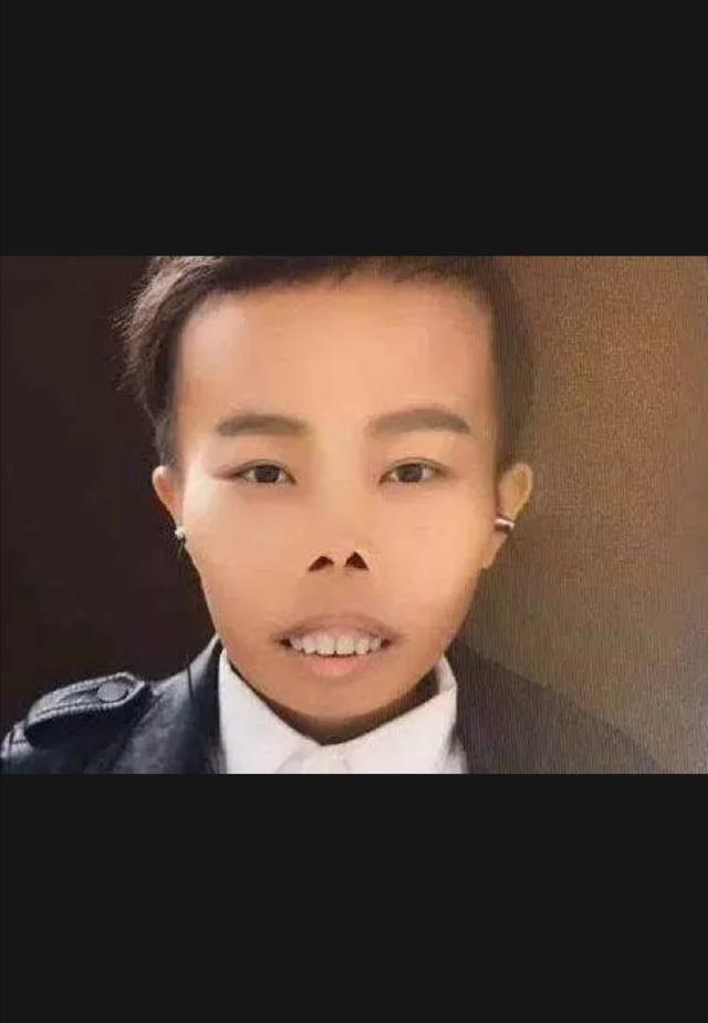 大口畸形的治疗 - 好大夫在线