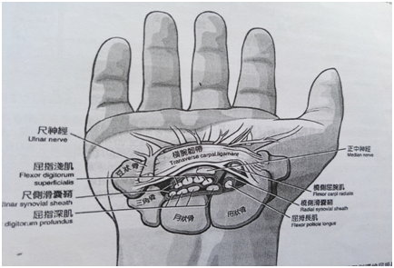 手屈肌腱修复后的康复(一)屈肌腱的分区及解剖