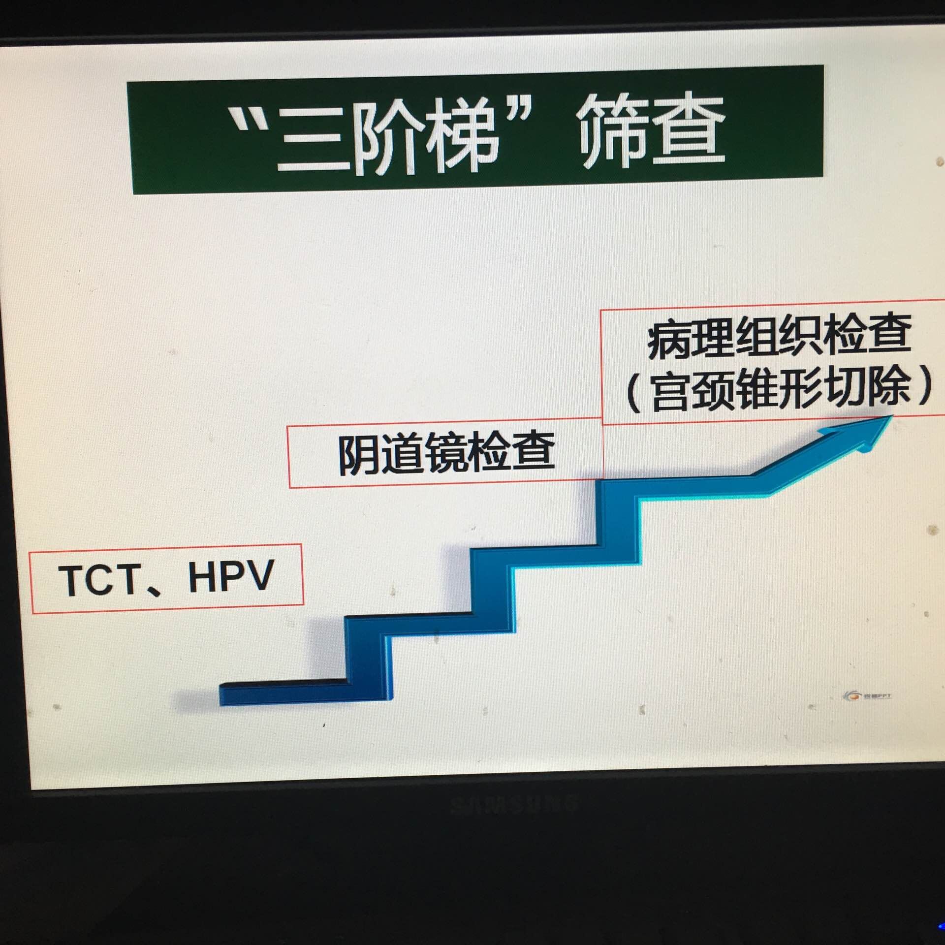 宮頸癌篩查的三階梯:hpv和tct,陰道鏡檢查,宮頸病理學診斷.