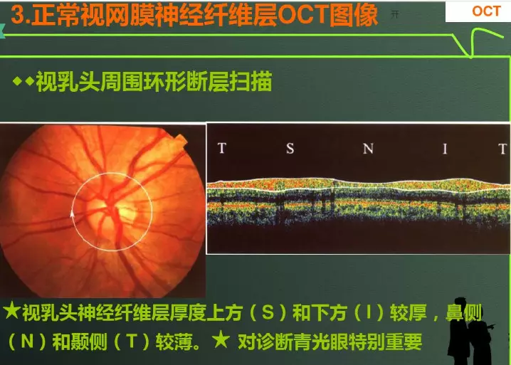 oct結果解讀ppt