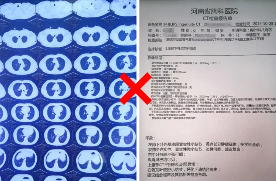 北京胸科医院CT加急-北京胸科医院ct加急多少钱 北京胸科医院CT加急-北京胸科医院ct加急多少钱
