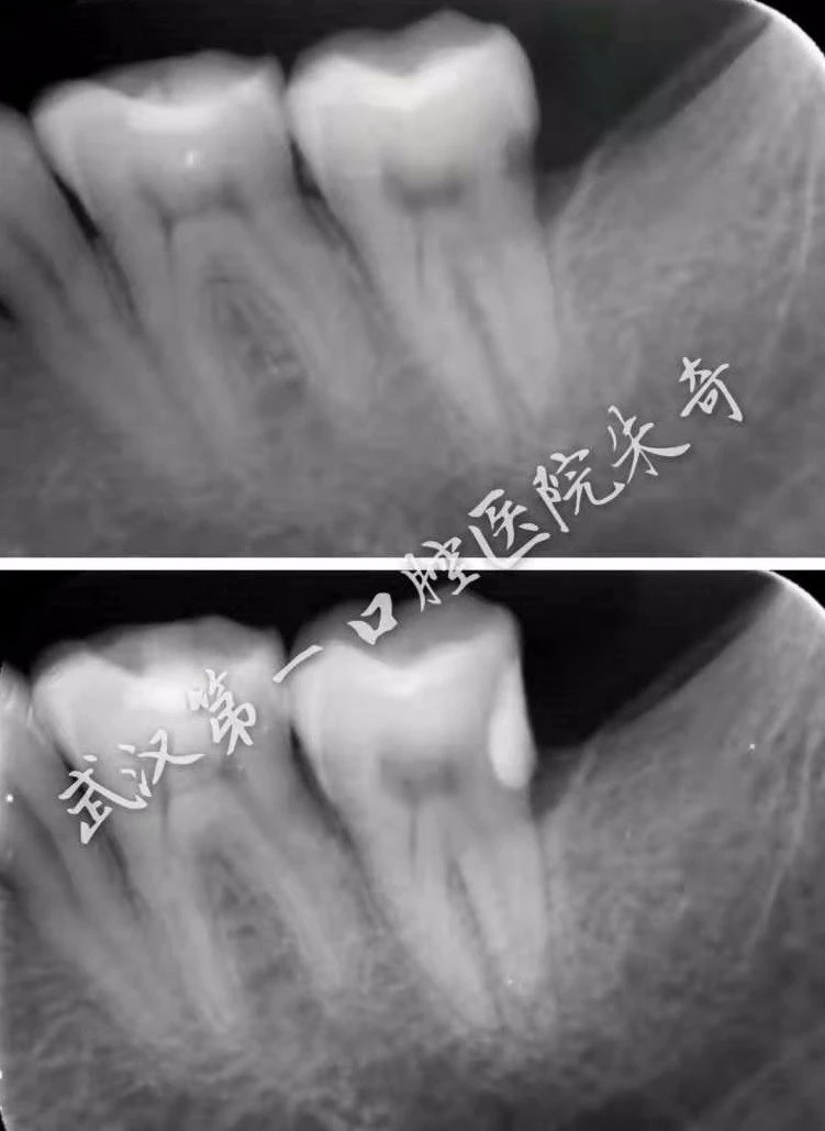 暂无