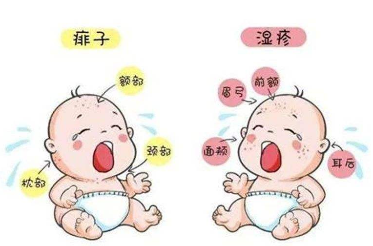 <!--HAODF:8:shizhen-->湿疹<!--HAODF:/8:shizhen-->和痱子的区别 南阳市第六人民医院 皮肤科.png