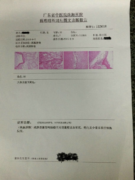 畸胎瘤图片病理报告图片
