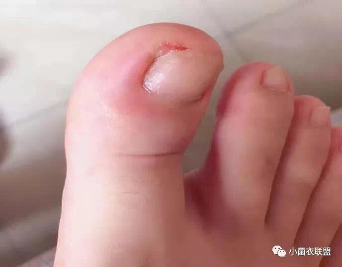 圖文圖片