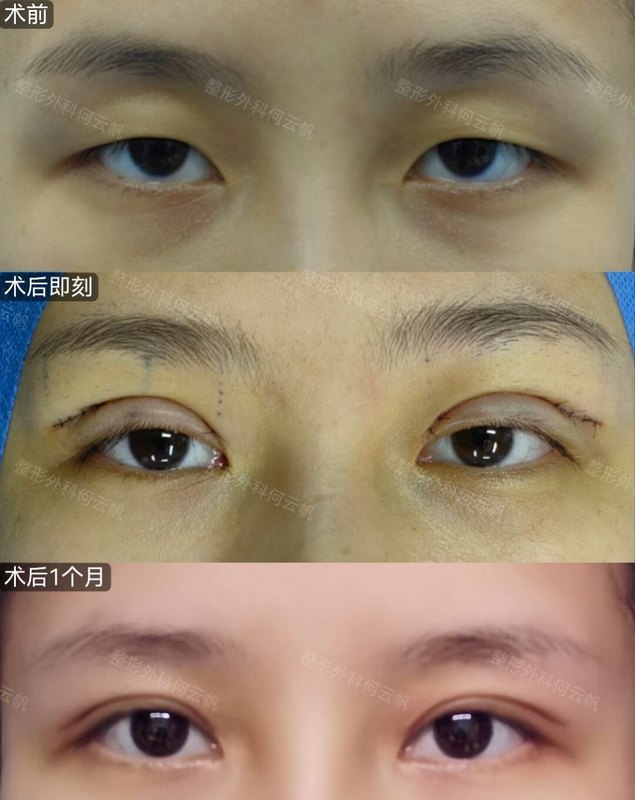 圖文圖片