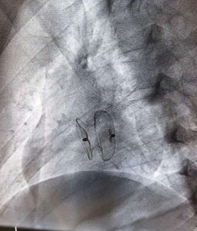 1622190337343685.png 1622190337343685.png